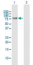 Anti-NEFL Rabbit Polyclonal Antibody