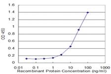 Anti-FABP4 Mouse Monoclonal Antibody [clone: 2G8]