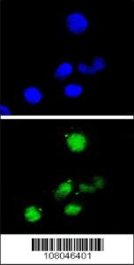 Anti-CDKN1A Rabbit Polyclonal Antibody (HRP (Horseradish Peroxidase))