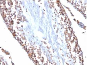 Anti-Wilms Tumor Protein Mouse Monoclonal Antibody [clone: WT1/857]