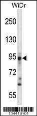 Anti-DSG3 Rabbit Polyclonal Antibody (APC (Allophycocyanin))