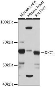 Western blot analysis of extracts of various cell lines, using Anti-DKC1 / Dyskerin Antibody [ARC1063] (A309088) at 1:1,000 dilution. The secondary antibody was Goat Anti-Rabbit IgG H&L Antibody (HRP) at 1:10,000 dilution.