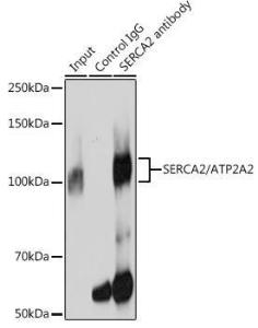 Immunoprecipitation analysis of 300µg extracts of 293T cells using 3µg of Anti-SERCA2 ATPase Antibody [ARC0679] (A306176). This Western blot was performed on the immunoprecipitate using Anti-SERCA2 ATPase Antibody [ARC0679] (A306176) at a dilution of 1:3000.