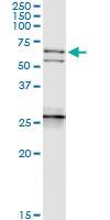 Anti-NEFL Rabbit Polyclonal Antibody