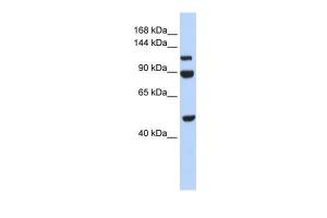 Anti-NAA16 Rabbit Polyclonal Antibody