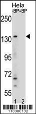 Anti-KDM6B Rabbit Polyclonal Antibody (HRP (Horseradish Peroxidase))