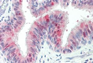 Anti-ZDHHC13 Antibody (A83315) (5 µg/ml) staining of paraffin embedded Human Lung. Steamed antigen retrieval with citrate buffer pH 6, AP-staining