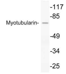 Western blot analysis of lysate from COLO205 cells using Anti-Myotubularin Antibody