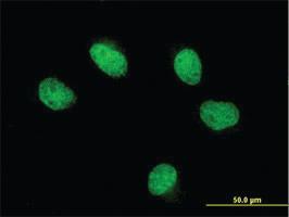 Anti-FOXQ1 Mouse Monoclonal Antibody [clone: 4H8]