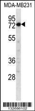 Anti-CAPN8 Rabbit Polyclonal Antibody (Biotin)