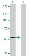 Anti-PTGIS Rabbit Polyclonal Antibody