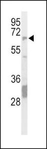 Anti-PTPN5 Rabbit Polyclonal Antibody