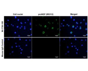 Immunofluorescence analysis of proNGF expression (green) in human DU145 prostate cancer cells. Cell nuclei were stained with Hoechst dye (blue). Magnification: 100x.