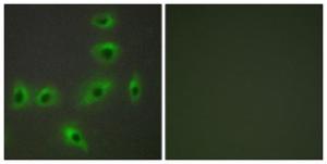 Immunofluorescence analysis of HUVEC cells using Anti-BAX Antibody. The right hand panel represents a negative control, where the Antibody was pre-incubated with the immunising peptide