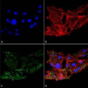 Immunocytochemistry/Immunofluorescence analysis of human colon carcinoma cell line (RKO), fixed in 4% formaldehyde for 15 min at room temperature, using Anti-ATG7 Antibody (A305058), at 1:100 for 60 minutes at room temperature