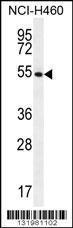 Anti-GSR Rabbit Polyclonal Antibody (AP (Alkaline Phosphatase))