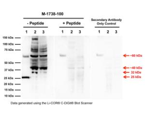 Western blot analysis of proNGF expression in DU145 and PC3 prostate cancer cell lysates. 