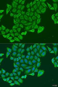 Immunofluorescence analysis of U2OS cells using Anti-EXOC2 Antibody (A307844) at a dilution of 1:100. DAPI was used to stain the cell nuclei (blue).