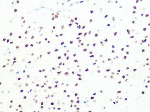 Immunohistochemistry analysis of paraffin-embedded rat brain using Anti-DKC1 / Dyskerin Antibody [ARC1063] (A309088) at a dilution of 1:100 (40x lens). Perform microwave antigen retrieval with 10 mM PBS buffer pH 7.2 before commencing with IHC staining protocol.