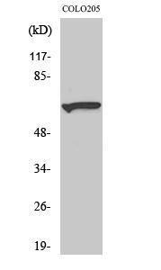 Western blot analysis of various cells using Anti-Myotubularin Antibody