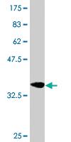 Anti-CDO1 Mouse Monoclonal Antibody [clone: 4B4]