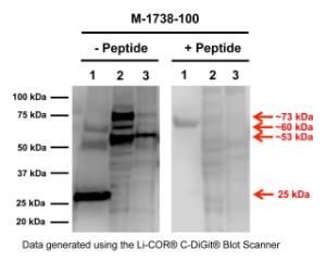 Western blot analysis of proNGF expression in human brain homogenates.