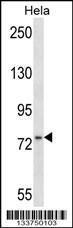 Anti-MSN Rabbit Polyclonal Antibody (Biotin)