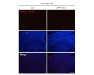 Immunohistochemical detection of amyloid plaques in the brain of 9 months old WT and APP/PS1 mice. Figure courtesy of Dr C.S. Ruan, University of South Australia