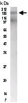 Anti-PTCH1 Rabbit Polyclonal Antibody