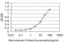 Anti-FOXQ1 Mouse Monoclonal Antibody [clone: 4H8]