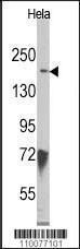 Anti-KDM6B Rabbit Polyclonal Antibody (AP (Alkaline Phosphatase))