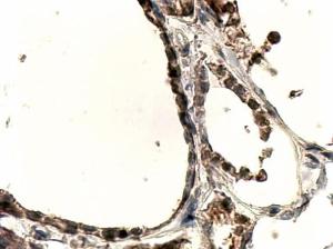 Anti-DUOX1 Antibody (A83317) (4 µg/ml) staining of paraffin embedded Human Thyroid Gland. Steamed antigen retrieval with Tris/EDTA buffer pH 9, HRP-staining