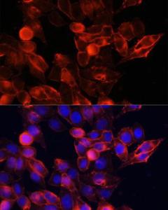 Immunofluorescence analysis of HeLa cells using Anti-CD44 Antibody (A93018) at a dilution of 1:100 DAPI was used to stain the cell nuclei (blue)