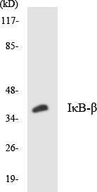 Western blot analysis of the lysates from HT 29 cells using Anti-IkappaB-beta Antibody