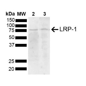 Western blot analysis of mouse, rat brain showing detection of 504.6 kDa LRP-1 protein using Anti-LRP1 Antibody (A305059) at 1:1,000 for 2 hours at room temperature with shaking