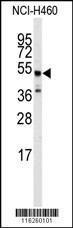 Anti-ADRB2 Rabbit Polyclonal Antibody