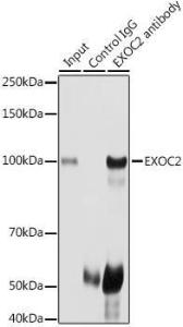 Immunoprecipitation analysis of 300µg extracts of HeLa cells using 3µg of Anti-EXOC2 Antibody (A307844). This Western blot was performed on the immunoprecipitate using Anti-EXOC2 Antibody (A307844) at a dilution of 1:1000.