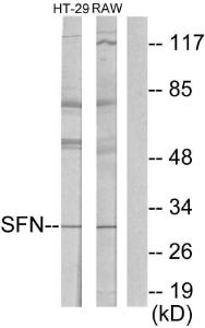 Western blot analysis of lysates from HT29 cells and RAW264.7 cells using Anti-14-3-3 sigma Antibody. The right hand lane represents a negative control, where the antibody is blocked by the immunising peptide.