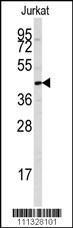 Anti-PTPN7 Rabbit Polyclonal Antibody (HRP (Horseradish Peroxidase))