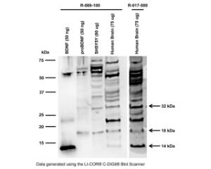 Western blot analysis of BDNF expression in SH-SY5Y cell lysate (RIPA) and human brain. 