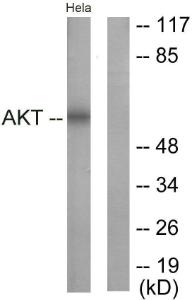 Anti-pan-AKT Rabbit Polyclonal Antibody