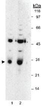 Anti-HPGD Rabbit Polyclonal Antibody