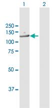 Anti-RANBP6 Mouse Polyclonal Antibody