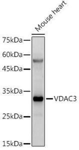 Western blot analysis of extracts of Mouse heart, using Anti-VDAC3 Antibody (A8647) at 1:500 dilution