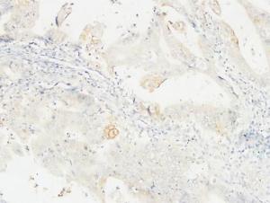 Immunohistochemical analysis of paraffin-embedded human colon using Anti-14-3-3 sigma Antibody