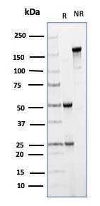 SDS-PAGE analysis of Anti-CD64 Antibody [FCGR1A/4950] under non-reduced and reduced conditions; showing intact IgG and intact heavy and light chains, respectively. SDS-PAGE analysis confirms the integrity and purity of the antibody.