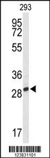 Anti-PNPO Rabbit Polyclonal Antibody