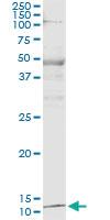 Anti-PTH Mouse Monoclonal Antibody [clone: 2E4]