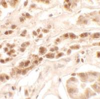 Anti-PTCHD2 Rabbit Polyclonal Antibody