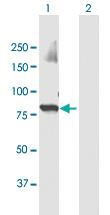 Anti-UBR3 Mouse Polyclonal Antibody